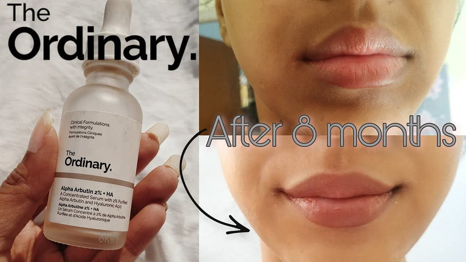 The Ordinary Salicylic Acid 2% Anhydrous Solution (G 2199)