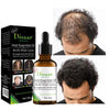 Anti-Hair Loss Essential Oil (NA-152)