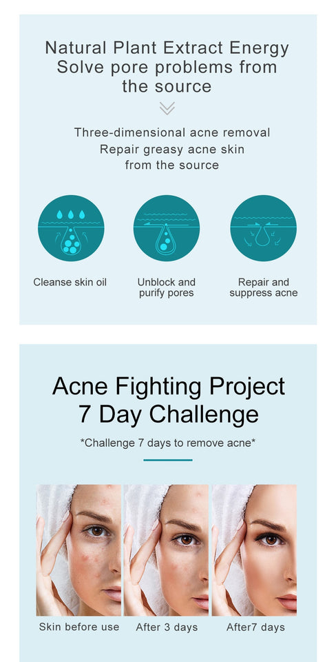 Acne Treatment Facial Cream Anti Oil Control By Tea Tree