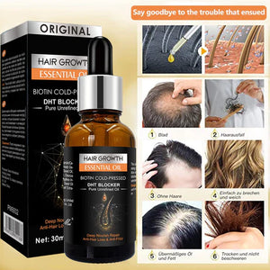 Hair Growth Essential Oil (NA-166)