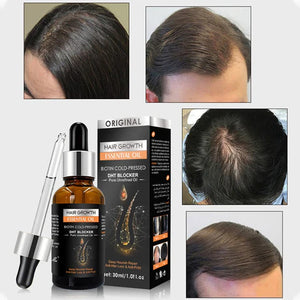 Hair Growth Essential Oil (NA-166)