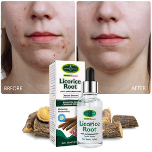 Herbal Licorce Anti Inflammatory Root Facial Face Serum